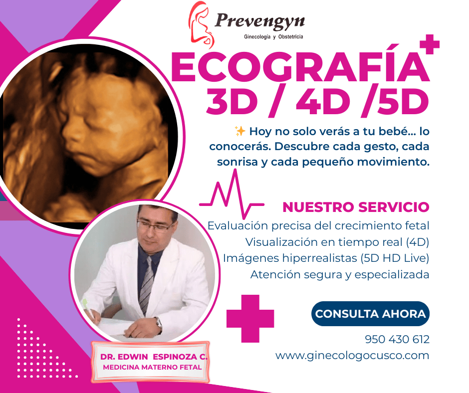 Mejores ginecologos en cusco Ginecologas Cusco ecografía morfologica 3D, 4D, 5D